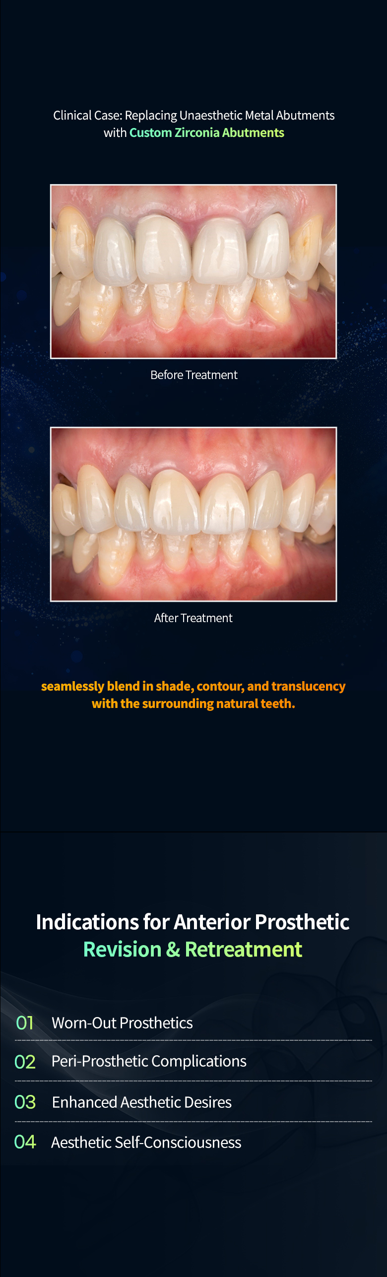 Anterior restoration, mobile image