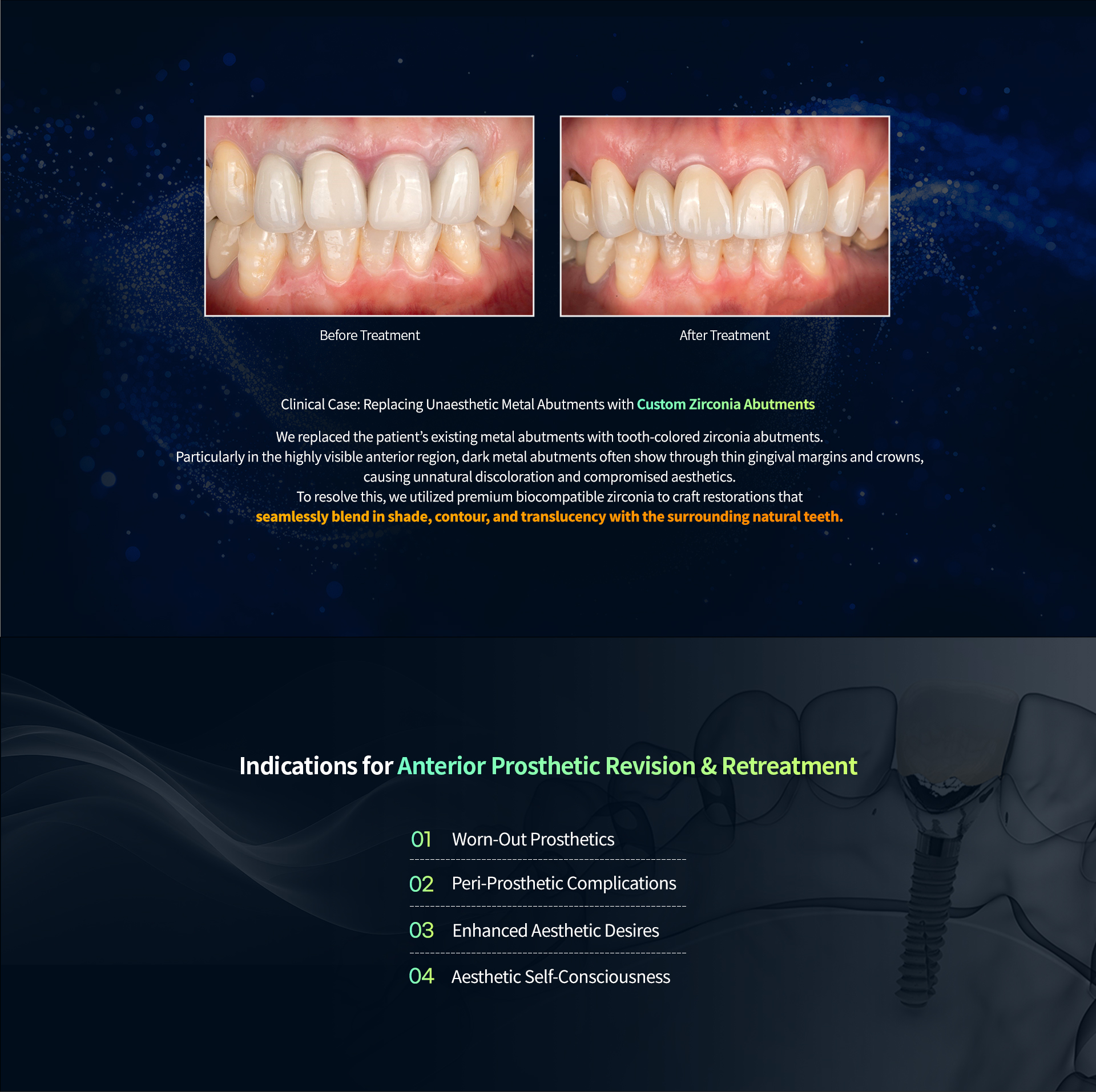 Anterior restoration, desktop image
