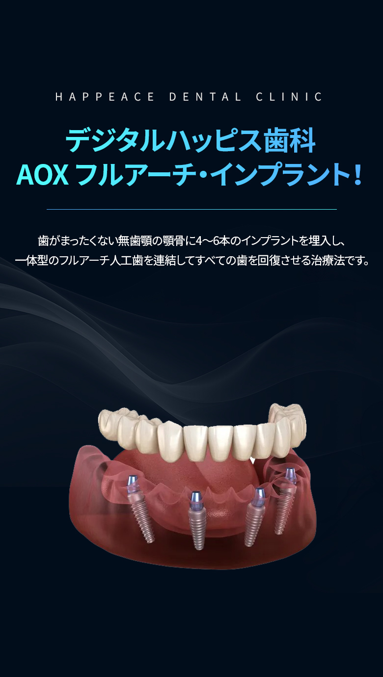 AOXフルアーチ・インプラント:無歯顎に4〜6本を埋入