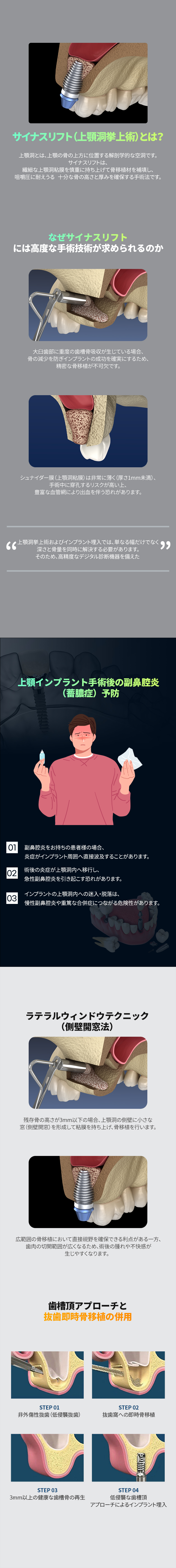 サイナスリフトの手術法:側壁開窓法と歯槽頂アプローチ