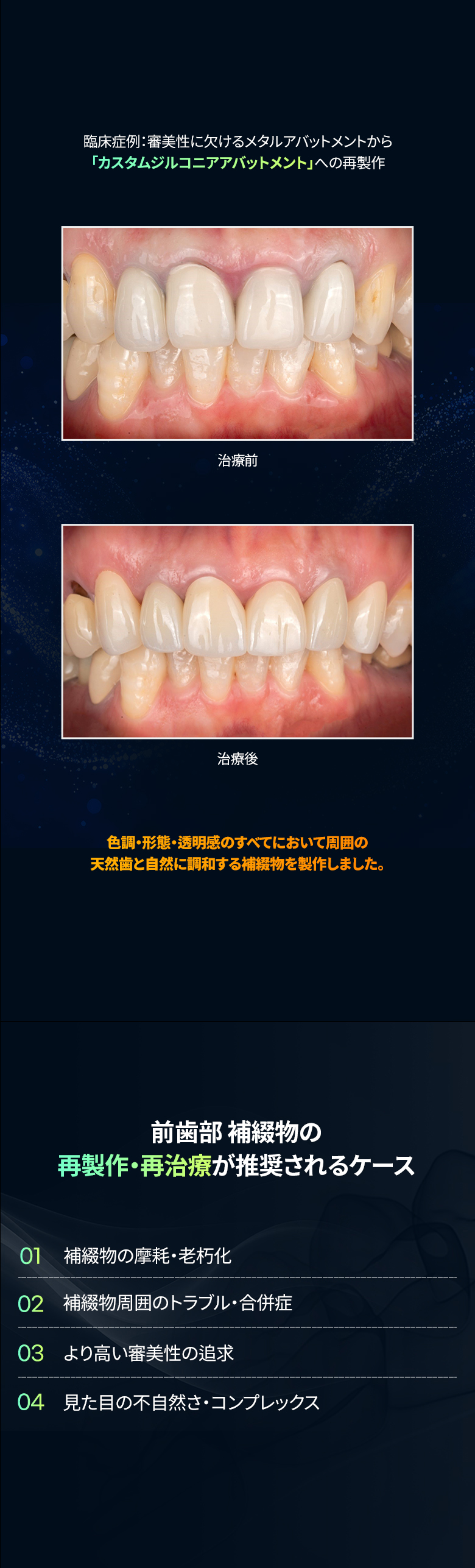 メタルアバットメントからジルコニアへの前歯再製作症例