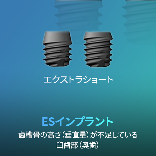 ESインプラント:歯槽骨の高さが不足している臼歯部用(エクストラショート)