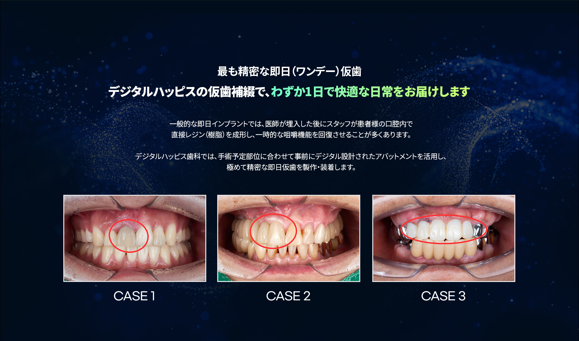 当日仮歯の説明とCASE 1〜3の口腔内写真