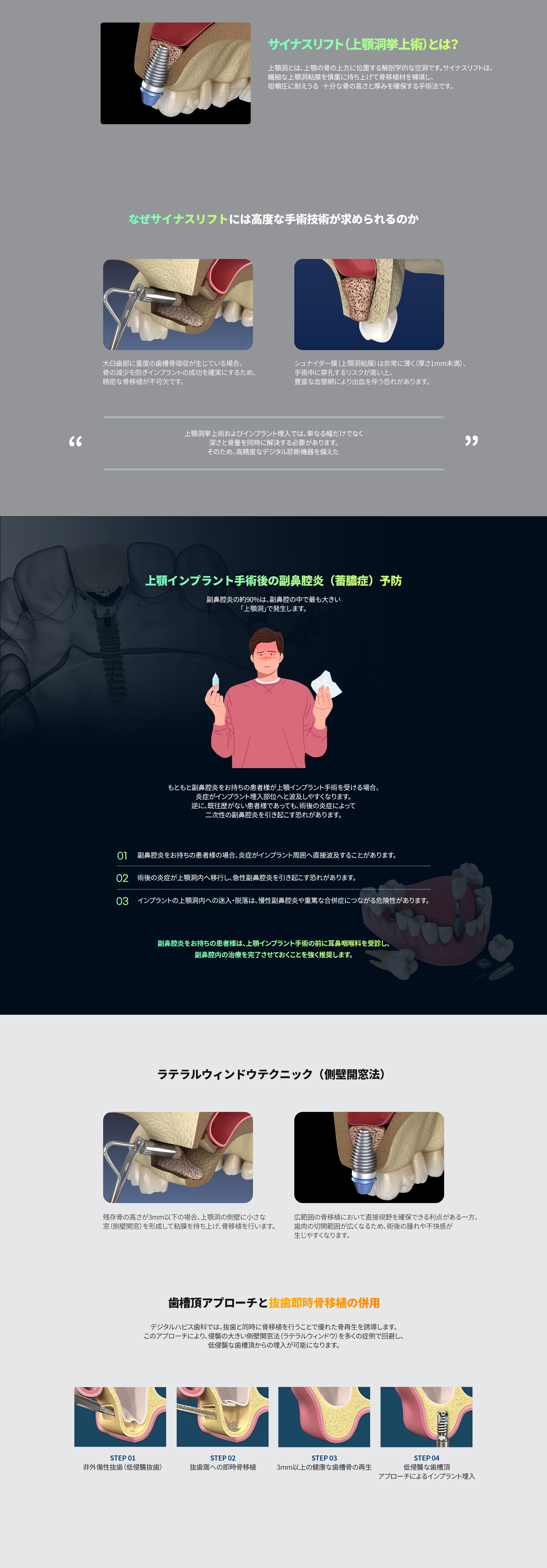 サイナスリフトの手術法:側壁開窓法と歯槽頂アプローチ